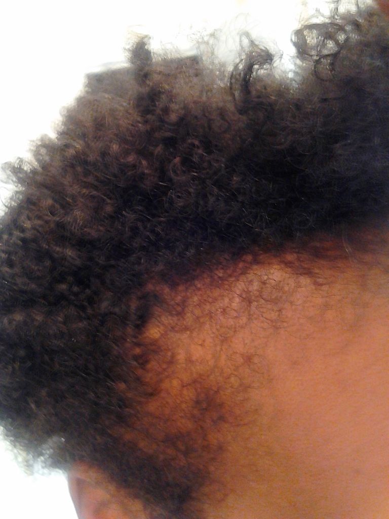 Nakia #2, Week 1: Current length 4.5".  Focused on bald spot in crown area and edges.  Looking for 3" of growth by end of challenge.